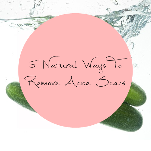 5 Natural Ways To Remove Acne Scars